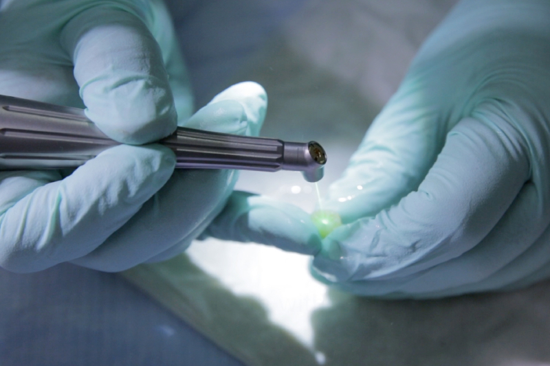 Gloved hand using laser beam on teeth